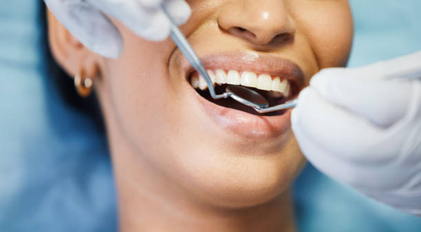 Best Broken or Chipped Tooth Repair in Honolulu, HI