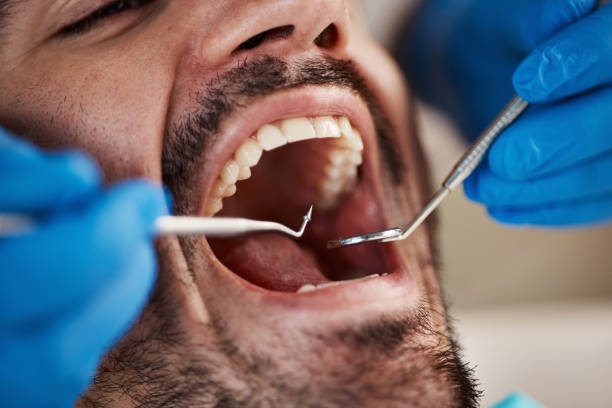 Best Emergency Treatment for Oral Infections in Honolulu, HI